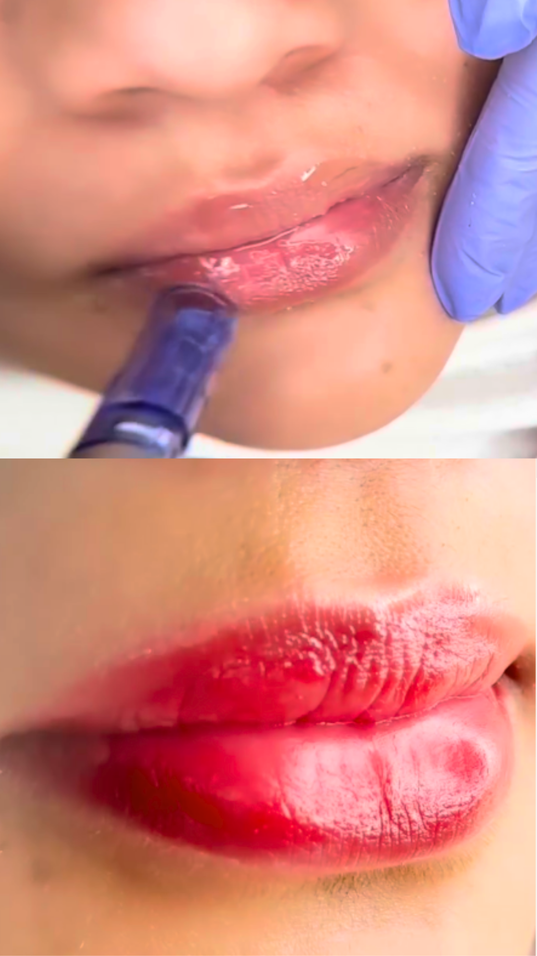 Before and After Result 8